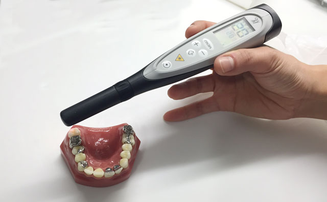 レーザーによる虫歯検査