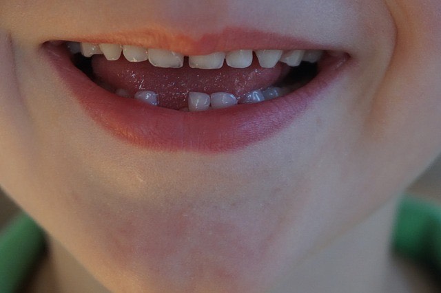 photo-3